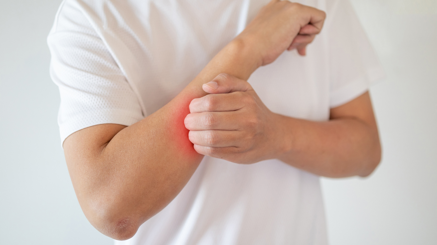 Suffering Due To Sensitive Skin